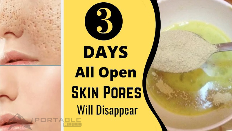 Days and All Open Pores Will Disappear from Your Skin Forever